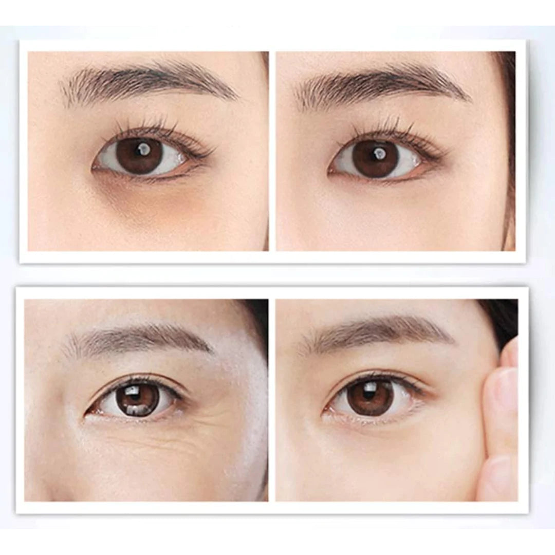 Crema Aclaradora de Ojeras y Bolsas Psiuan